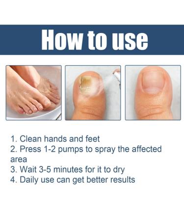 Furzero Nail Fungus & Athlete's Foot Treatment Spray - Medical Grade Anti-Itch Relief (3pcs) - Buy Online on GoSupps.com