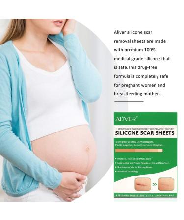 Silicone Scar Sheets for C-Section Surgery, Burns, Keloids, Acne & More - 4 Reusable Strips - 2 Months Supply - Buy Online on GoSupps.com