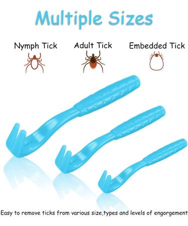 Boao Tick Removal Kit with 3 Plastic Removers & 3 Stainless Steel Tweezers for Pets - Light Blue - Buy Online on GoSupps.com