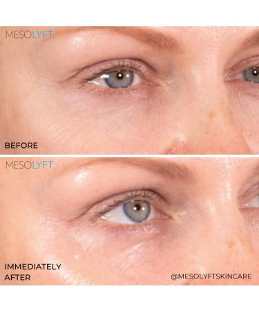 Neck & Eyes Combo Skincare Tool | Under Eye Serum & Neck Line Remover | Wrinkle Filler & Exfoliator for Firm Smooth Skin - Buy Online on GoSupps.com