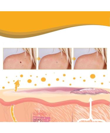 Shop Tag Recede Bienengift & Wart Removal Spray Effective Skin Treatment for All | International Shipping - Buy Online on GoSupps.com