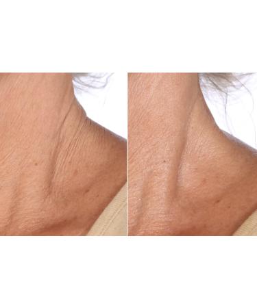 Nakery SkinToning Body Butter | Crepe Smoothing + Repair | Infused with Niacinamide Caffeine Tri-Hyaluronic Acid (Sunshine Bouquet) - Buy Online on GoSupps.com