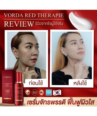 Vorda Red Therapie Serum Facial 30ml - Korean X50 Photoglow for Radiant Skin | International Shipping - Buy Online on GoSupps.com