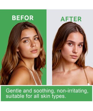 2PCS Tan Remover Self 60 Second Tan Remover Gentle Self Tan Eraser Exfoliating Tan Eraser Body Scrub Fast Erase Patches & Prep for Flawless Tan - Buy Online on GoSupps.com