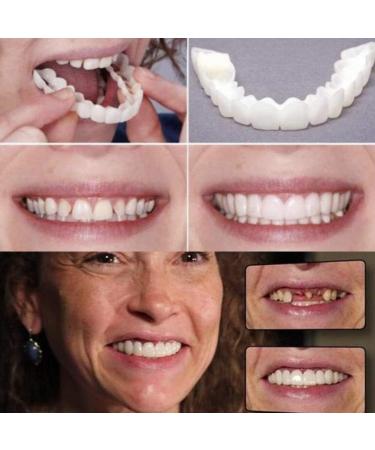 Buy 2 Pairs Dental Veneers - Provisional Dentures & Teeth Whitening Kit for Men & Women | Perfect Your Smile Instantly - Buy Online on GoSupps.com