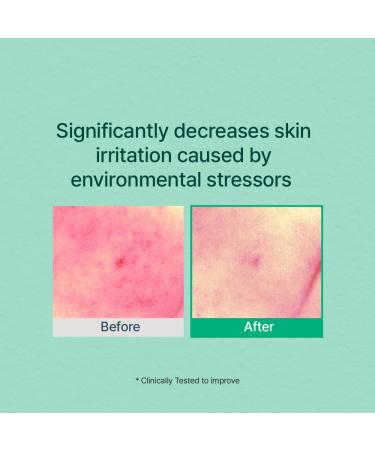 Green Caper Hydrating Essence Toner for Sensitive & Dry Skin - Vegan Cruelty-Free Korean Skincare (4.39 Fl Oz - Buy Online on GoSupps.com