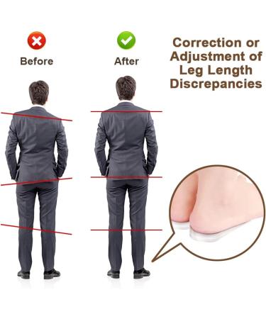 Abnaok Heel Lift - 4 Layer Gel Shoe Inserts for Women | Adjustable Orthopedic Heel Lifts for Pain & Leg Length Discrepancy | 2 Pairs Wedge Inserts - Buy Online on GoSupps.com