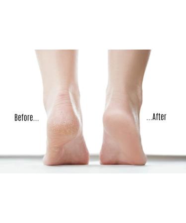 Skinapeel Large Pumice Stone - Natural Foot Care Scrubber & Callus Remover - Buy Online on GoSupps.com