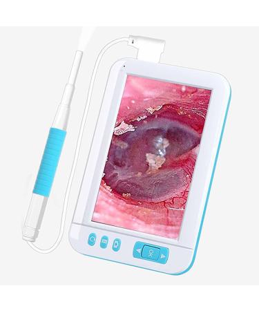 HSRG portable digital otoscope HD 1080p 3.9 mm lens-ear cleaner with 4.3-inch IPS screen and 6 LED lights portable ear scope for adults children and pets