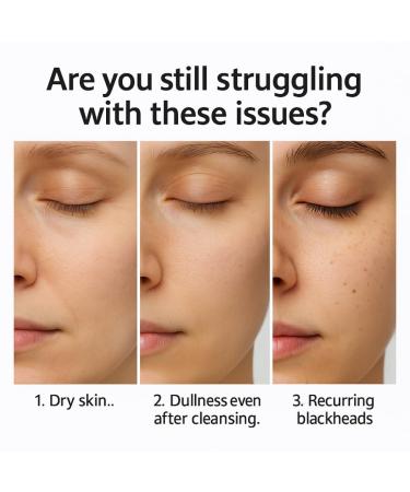 3PCS Black Rice Face Serum with Rice Bran Water Niacinamide & Lactic Acid Gently Exfoliates Reduces Blackheads & Brightens - Buy Online on GoSupps.com