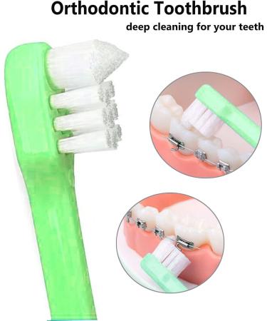 4-Piece Tuft Toothbrush Set - Jaw-Friendly Compact Interdental Brushes for Braces & Dental Implants | Style A - Buy Online on GoSupps.com