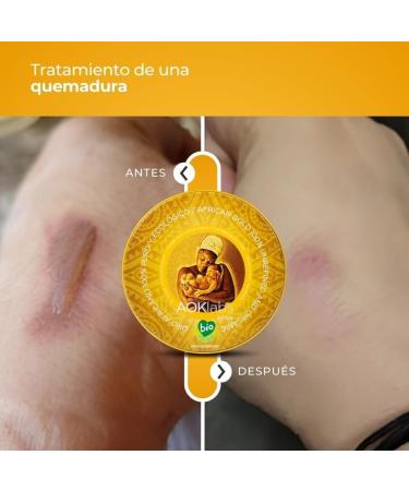 AOKLABS African Gold Shea butter 100 organic unrefined 50ML - Buy Online on GoSupps.com