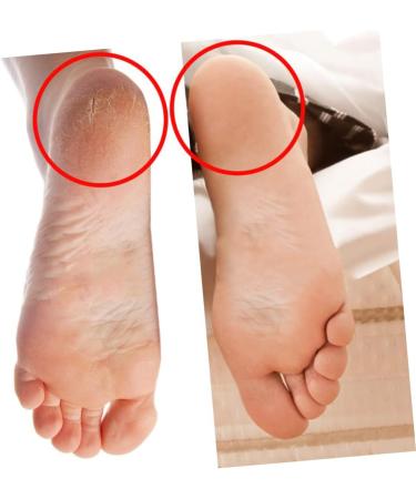 FOMIYES 2 Pairs Silicone Gel Heel Socks Lotion Socks Sebs Socks Moisturising Gel Socks Silicone Socks Floor Socks Room Socks Non Slip Socks Plantar Insoles Heel Cover Invisible - Buy Online on GoSupps.com
