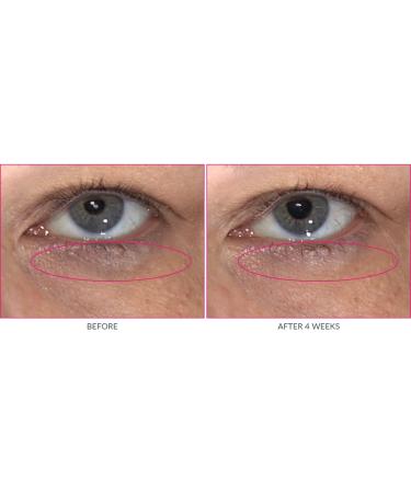 Kate Somerville Wrinkle Warrior Eye Gel - Dark Circle Eraser | Plumps & Hydrates Under Eye Skin | 0.3 Fl Oz - Buy Online on GoSupps.com