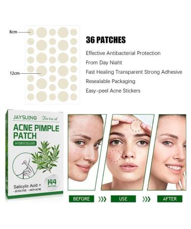 Tea Tree Oil Hydrocolloid Acne Pimple Patches - Waterproof Moisturizing & Invisible Makeup - Fade Acne & Skin Marks | International Shipping - Buy Online on GoSupps.com