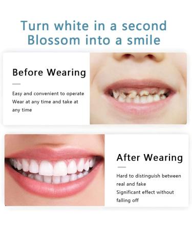 Second Gen Silicone Fake Braces Set for Upper and Lower Teeth Simulation - Snap On Smile & Teeth Whitening Option - Buy Online on GoSupps.com