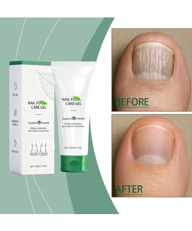  JIAOY Natural Nail Care Gel Strengthening Serum for Damaged and Brittle Cuticles Nail Growth Repair Cream Foot Moisturizer and Repair Cream (1PCS) - Buy Online on GoSupps.com