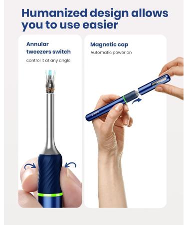 Buy Bebird Note 5 Ear Camera Wax Removal Tool - 10MP Otoscope & 12 Ear Spoons for Effective Ear Cleaning | International Shipping Available - Buy Online on GoSupps.com