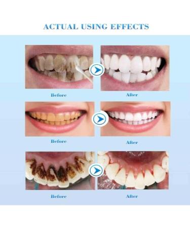 Activated Charcoal Toothpaste for Whiter Teeth | Bamboo Charcoal Whitening Paste - Deep Clean & Fresh Breath (2 PCs) - Buy Online on GoSupps.com