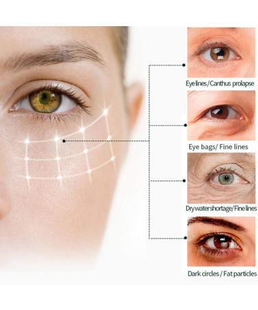 2pcs Vitamin C Eye Cream Set | Anti-Wrinkle, Dark Circles Removal & Moisturizing (25ml) - Buy Online on GoSupps.com