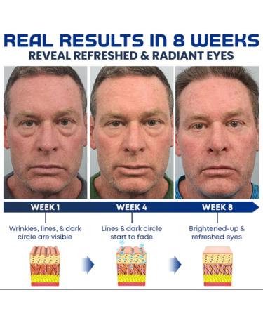 Openeyes Awaken Peptide Lifting Eye Gel for Men - 5Pcs | Reduce Fine Lines, Dark Circles & Wrinkles | Retinol Eye Cream for Anti-Aging & Depuffing - Buy Online on GoSupps.com
