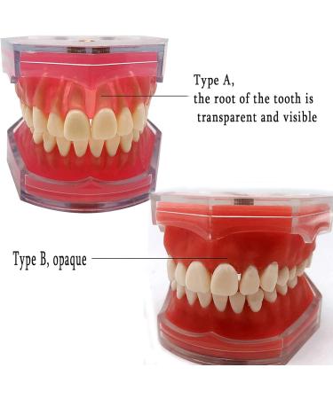 PURFWOG Dental Teeth Model - Disassembled Full Mouth Teeth Crown Model with Soft Gums for Dental School Study & Teaching - Buy Online on GoSupps.com