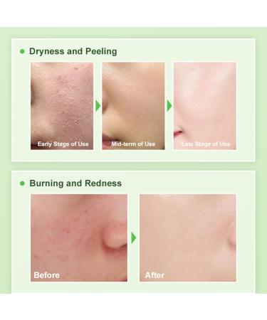 Squalane Anti Aging Face Cream- Anti Wrinkle Face Cream - Moisturiser Face Women - Barrier Repair Cream - High Efficiency Squalane Ingredients - Face Cream for Deeply Nourishes Skin - Buy Online on GoSupps.com