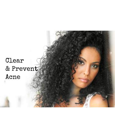 All-Natural Loma Lux Acne Pill - Dermatologist-Developed, Clears & Prevents Face & Body Acne - Buy Online on GoSupps.com
