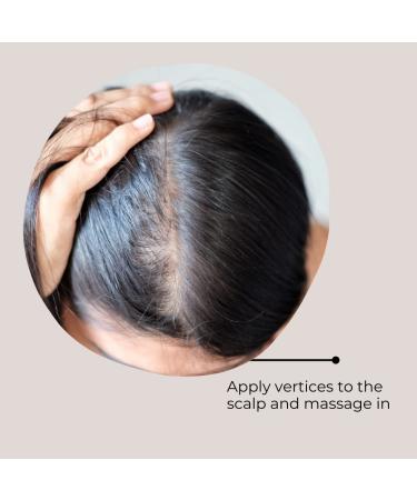 Buy ALCINA It's Never Too Late Caffeine Vital Scalp Serum 100ml | Best for Thinning Hair & Hair Loss | International Shipping Available - Buy Online on GoSupps.com