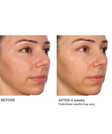 NassifMD Hydro-Gel with Hylauronic Acid Moisturizer Salicylic Acid Serum Retinol Serum for Face - Buy Online on GoSupps.com