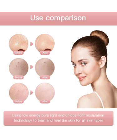 LED Face Mask - 7-Color Photon Therapy for Acne & Wrinkle Removal | Pink Beauty Rejuvenation Mask - Buy Online on GoSupps.com