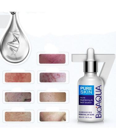 BIOAQUA Acne Scar Liquid Replenishment Treatment Natural Blemish Gel Acne Pimple Acne Spot Removal Oil Control Shrink Pores Face Care Essence 30 ml - Buy Online on GoSupps.com