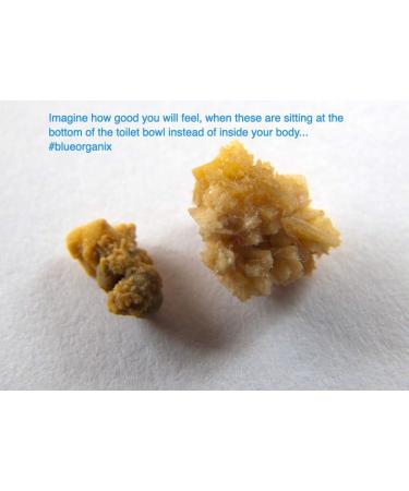 Chanca Piedra Extract 2oz - Natural Kidney Stones Support & Gallbladder Cleanse from Peru - Buy Online on GoSupps.com