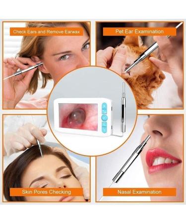 Yannies Ear Wax Removal Endoscope Ear Wax Removal Camera with 4.3 IPS Screen 1280x1080 FHD Smart Visual Ear Cleaner with Camera Tool Kit Plug & Play at Home Ear Infection Detector Ear Wax Remover O - Buy Online on GoSupps.com