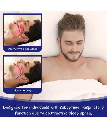 ACWOO Nasal Strips 30PCS - Stop Snoring and Relieve Nasal Congestion - Anti Snore Strips for Improved Sleep - Men & Women's Nasal Aid - Buy Online on GoSupps.com