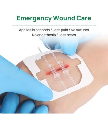 5pcs Zip Stitch Suture Free Wound Closure Strips | Butterfly Bandages for Emergency Laceration Repair - First Aid Kit Essential - Buy Online on GoSupps.com