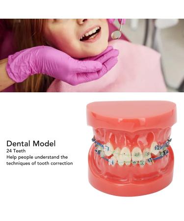 Buy GFRGFH Dental Model with 24 Teeth - Half Metal Half Ceramic Bracket for Teaching & Study - International Shipping Available - Buy Online on GoSupps.com