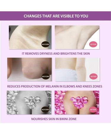 AICHUN BEAUTY Hot 50g Whitening Safe natural ingredients cream Get Rid of Dark Armpit/Inner thigh/Elbow/Knee Fast - Buy Online on GoSupps.com