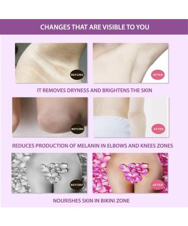 Aichun Beauty Fast Bleaching Cream for Sensitive Areas | Collagen & Milk Complex Whitening & Rejuvenating Body Skin Care - Buy Online on GoSupps.com