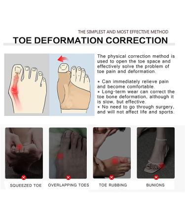 2 Pairs Soft Breathable Toe Separator Sleeves with Gel Spacer for Big Toe Alignment and Pain Relief - Hammer Toe Corrector for Bunions and Overlapping Toes (Size S) - Buy Online on GoSupps.com
