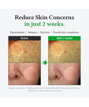 Celleco Dr Althea Gentle Vitamine C Serum 20 30 ml - Buy Online on GoSupps.com