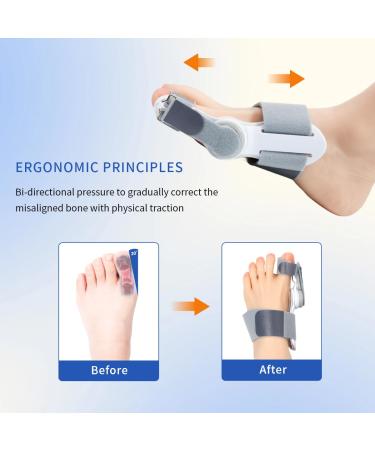 Bunion Corrector - Orthopedic Big Toe Straighteners | Adjustable Separator for Men & Women | Silicone Pad Bunion Splint for Pain Relief - Buy Online on GoSupps.com