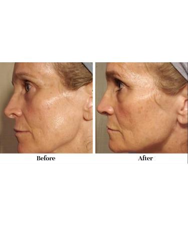 Buy City Beauty Barrier Rescue Firming Night Cream | Anti-Aging Overnight Moisturizer with Peptides & Lipids - Plump Dry Skin Reduce Wrinkles & Sagging - International Shipping Available - Buy Online on GoSupps.com
