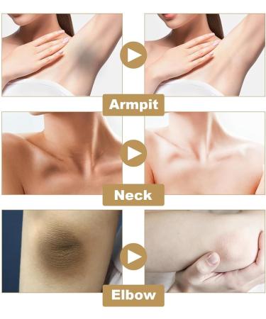 Melan Txa Body Lotion Whitening Body Lotion HD Cosmetic Efficiency Melan Txa Body Lotion Firming Lotion Soft Moisturizing Cream Lightweight & Non-greasy (1pcs) - Buy Online on GoSupps.com