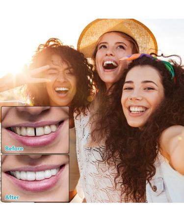Buy False Teeth Veneers | Cosmetic Tooth Covers & Provisional Dentures - International Shipping - Buy Online on GoSupps.com