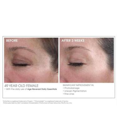 Glowbiotics Advanced Retinol Renewal Treatment - Nightly Anti-Aging & Brightening Cream | Tightens Smooths Firms Skin | 1 Fl Oz - International Shipping Available - Buy Online on GoSupps.com