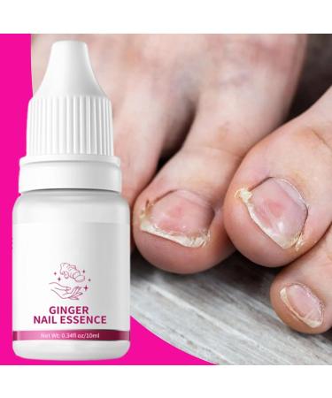Nail Softener - Nail Strengthening Oil 10ml - Moisturizing Repair Care Nails Hands And Feet Sensitive Skin Men Women Daily Use Night Travel Manicure Pedicure - Buy Online on GoSupps.com