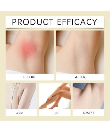 Cyperus Rotundus Oil for Hair Removal 100% Pure Natural Serum to Reduce Unwanted Hair Growth Moisturizes & Soothes Skin & Hair 2.02 Fl Oz - Buy Online on GoSupps.com