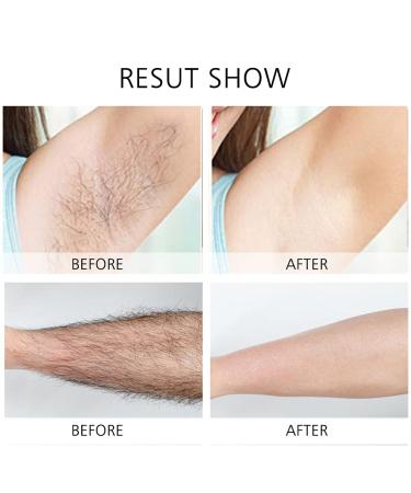 AHUADA Women's Electric Shaver Replacement Heads - 5 Legs Hair Removal Razor Blades - Buy Online on GoSupps.com