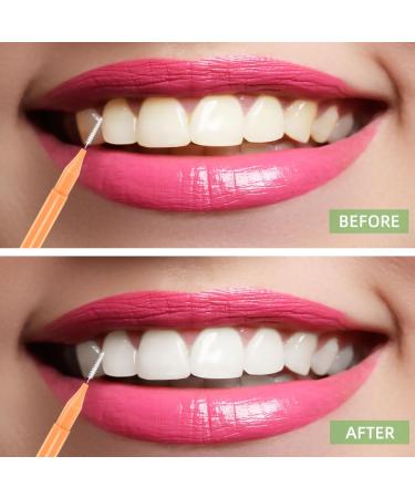 75-Piece Braces Brush Set | Interdental Cleaning & Dental Hygiene Tools | Bendable Flosser | 5 Color Options - Buy Online on GoSupps.com